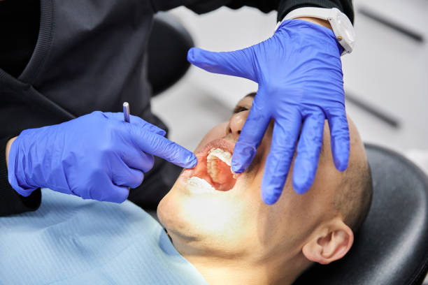 Best Urgent Care for Lost Fillings or Crowns in Lebanon, TN